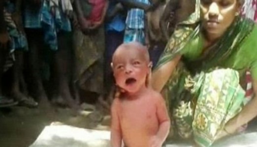 ΣΟΚΑΡΙΣΤΙΚΟ: Δείτε τί έκαναν σε αυτό το 2 ημερών μωράκι στην Ινδία!