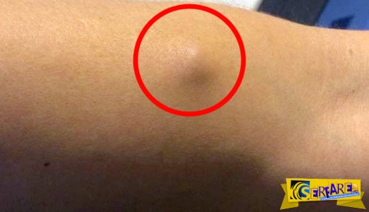 Εδώ και χρόνια είχε αυτό το σημάδι στο χέρι του. Όταν έμαθε τι ήταν, έπαθε το ΣΟΚ της ζωής του…