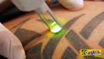 Πως μπορείτε να σβήσετε το τατουάζ σας...