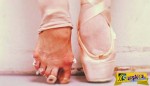 Ο απόλυτος πόνος – Δείτε τι περνούν οι χορευτες μπαλέτου!