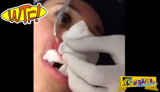 Απίστευτο: Δείτε τι ανακάλυψαν οι γιατροί μέσα στο χείλος της κοπέλας ...