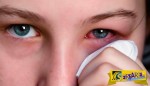 Κριθαράκι στο μάτι: Τα 5 βήματα στο σπίτι που θα σας σώσουν