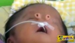 ΣΟΚ: Μωρό χωρίς μύτη γεννήθηκε στο Περού!