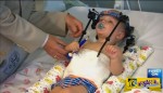 Ένα Τροχαίο ήταν η αιτία που αυτό το μωρό υπέστη «Εσωτερικό Αποκεφαλισμό»! Σήμερα οι γιατροί κάνουν ένα θαύμα…