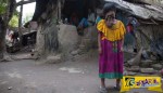 Ινδία: Η κοπέλα που γεννήθηκε χωρίς πρόσωπο!
