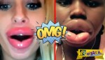 Νέα μόδα στην Αμερική- Νεαρές κοπέλες πρήζουν τα χείλη τους και το ανεβάζουν στο διαδίκτυο!