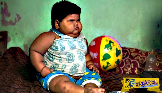 Ανεξήγητη η υπόθεση του παχύσαρκου μωρού της Ινδίας!