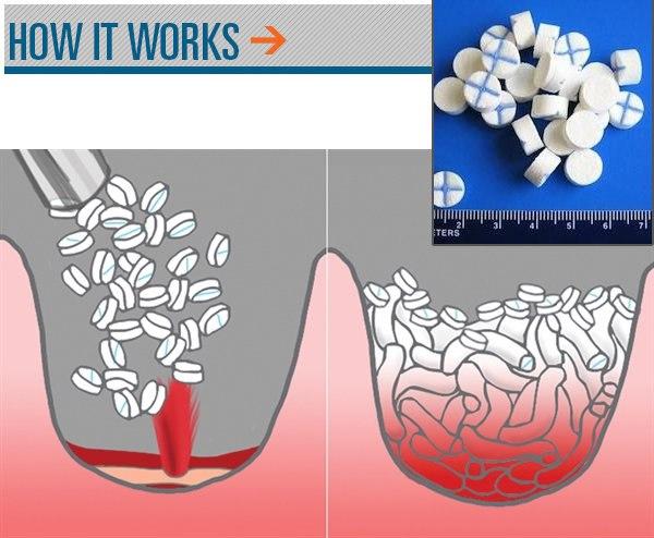 aimostatiki-syskevi-2