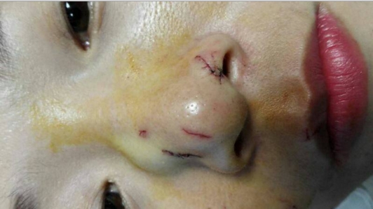 pythonas-dagoma-prosopo-2