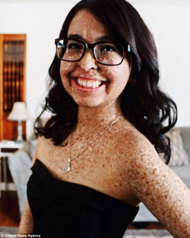 syndromo-vrykolaka-1