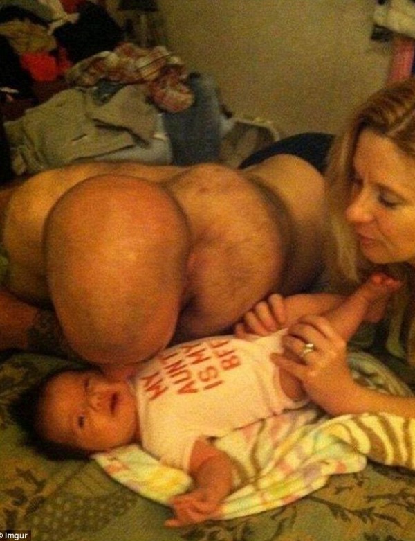 Μόλις δείτε αυτή τη φωτογραφία αρχικά θα αηδιάσετε, αλλά μετά θα συγκινηθείτε!