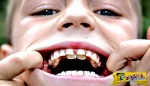 Οκτάχρονος έχει δύο σειρές δόντια!