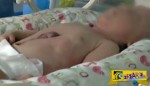 Συγκλονιστικό: Μωράκι γεννήθηκε με την καρδούλα του έξω από το σώμα του!