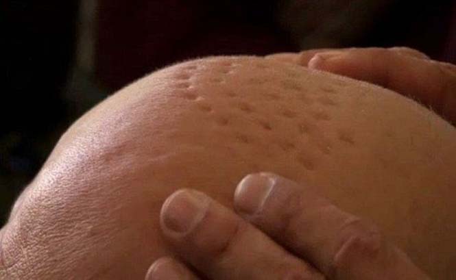 apotyximeni-emfyteusi-malliwn-5