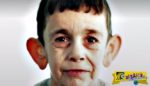 Προγηρία: Ο 7χρονος που “ζει στο σώμα” 70χρονου – Συγκλονίζουν οι εικόνες!