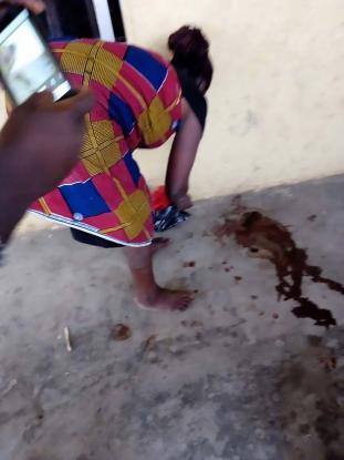 Γυναίκα ήταν έγκυος για δυο χρόνια και γέννησε μια... κατσίκα!