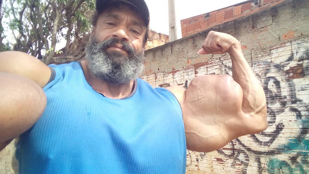 Valdir Synthol: Κάνει ενέσεις με συνθετικό λάδι αυτοκινήτου για να φαίνεται γυμνασμένος